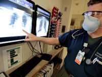 Dr, Gregory Hunt looks at the x-rays of a COVID-19 patient.  The one on the right a current x-ray showing his infected lungs, compared to an x-ray on the right of the same patient taken a year ago at Tobey Hospital in Wareham.  PHOTO PETER PEREIRA